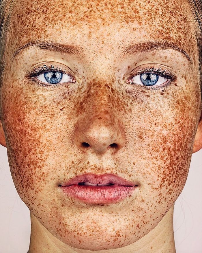 The Beauty of Freckles by Brock Elbank