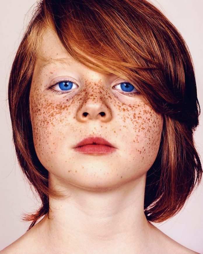 The Beauty of Freckles by Brock Elbank | Art Ctrl Del